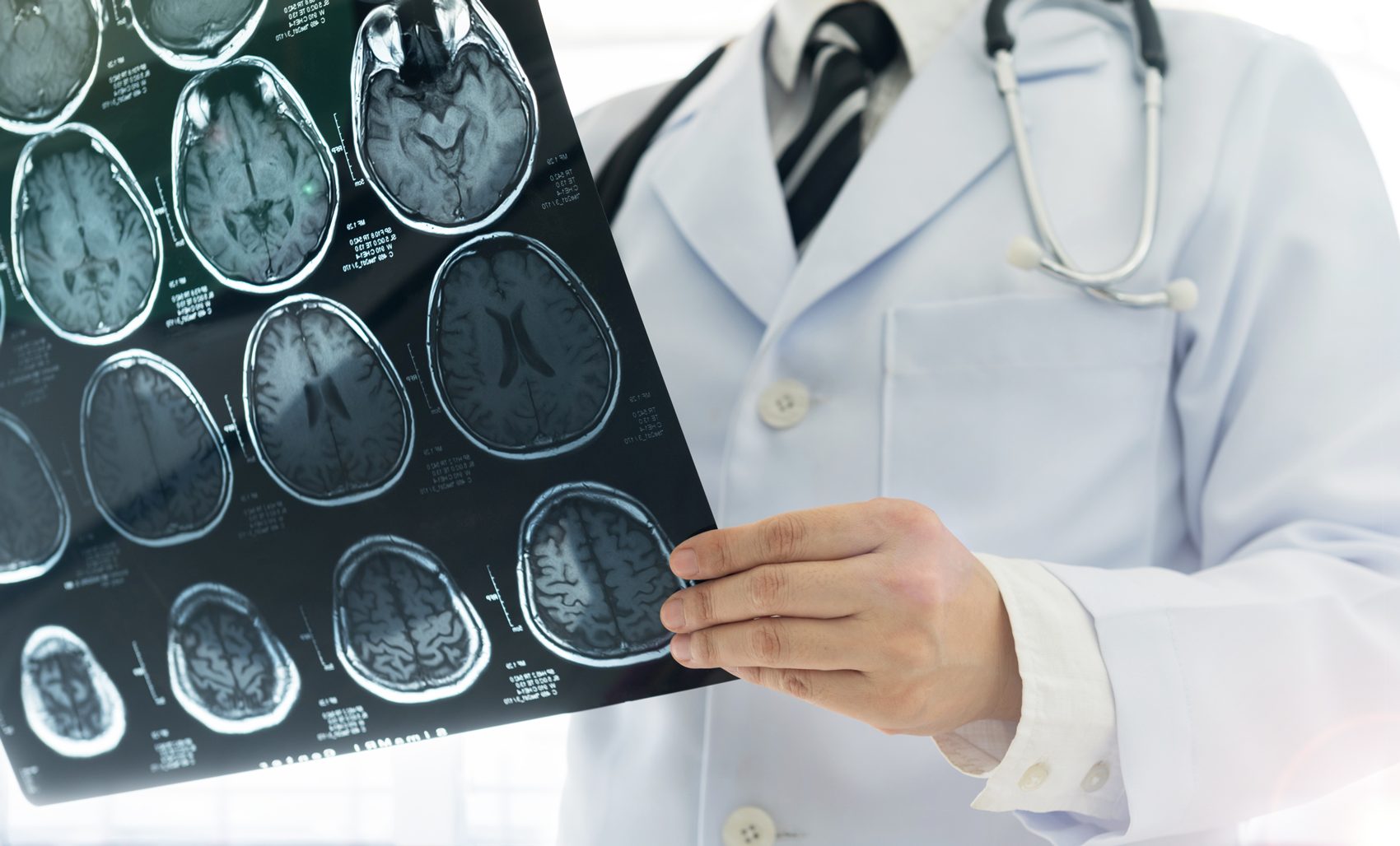 risonanza neurologia